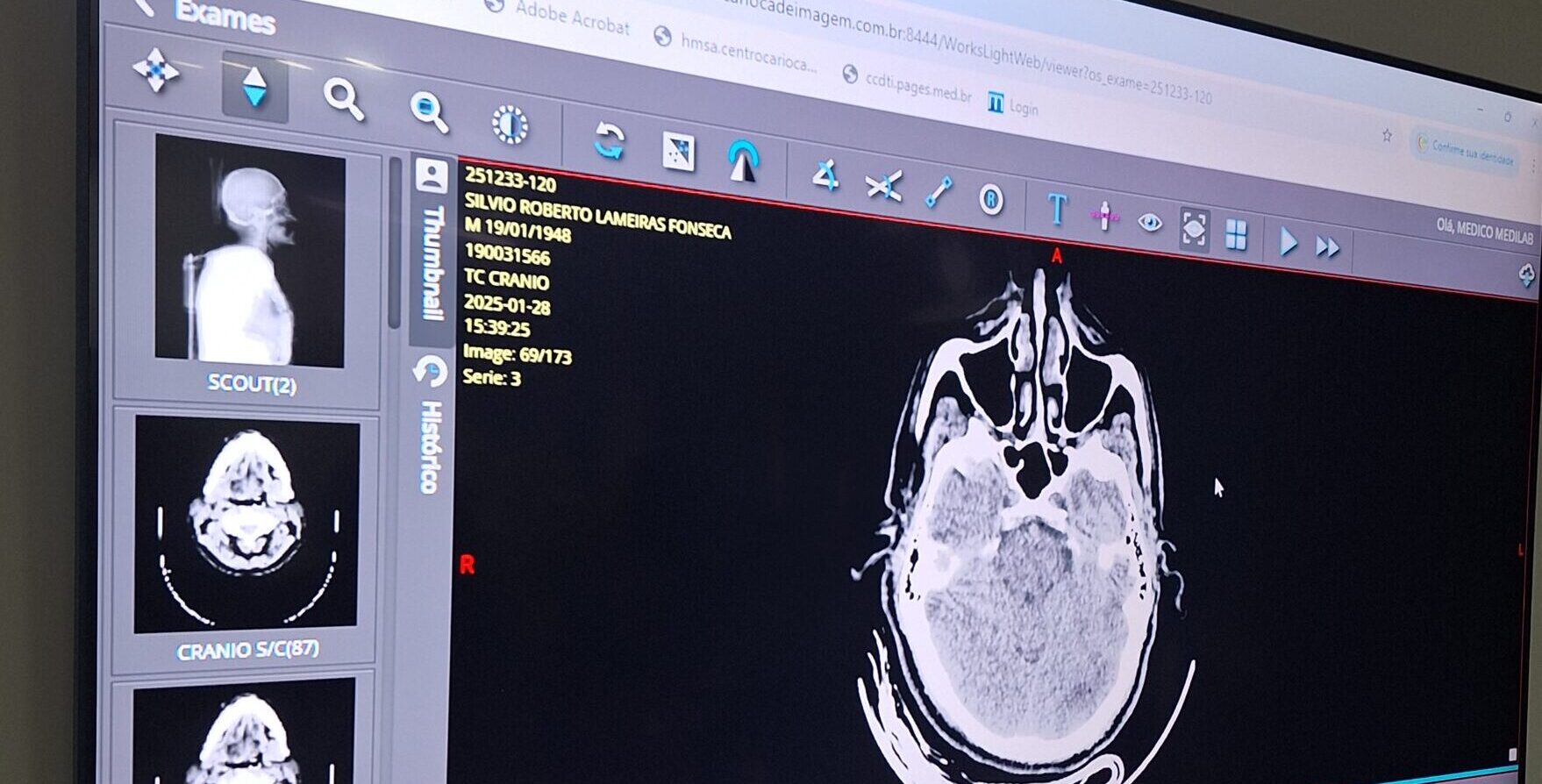 SESSÃO CLÍNICA DO PROGRAMA DE RESIDÊNCIA EM MEDICINA DE EMERGÊNCIA – HMSA